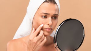Como usar maquiagem sem piorar a acne