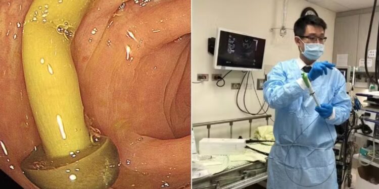 cogumelo no intestino