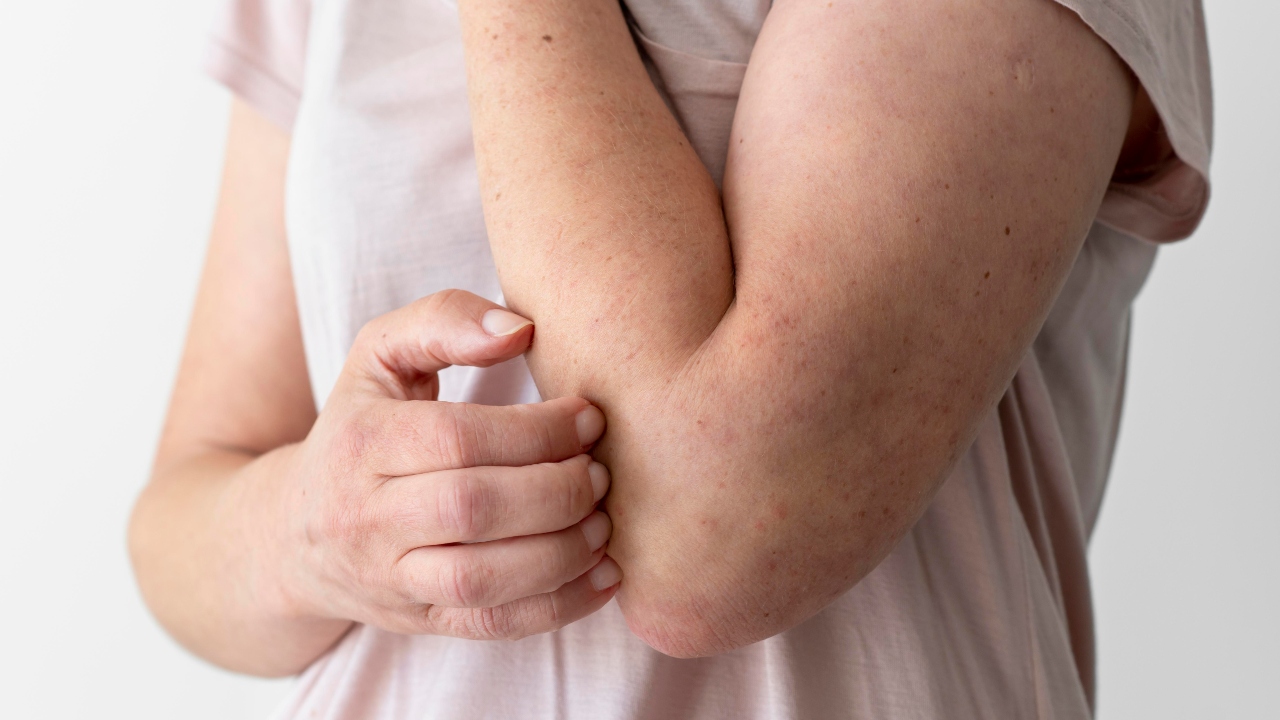 alergia a humanos