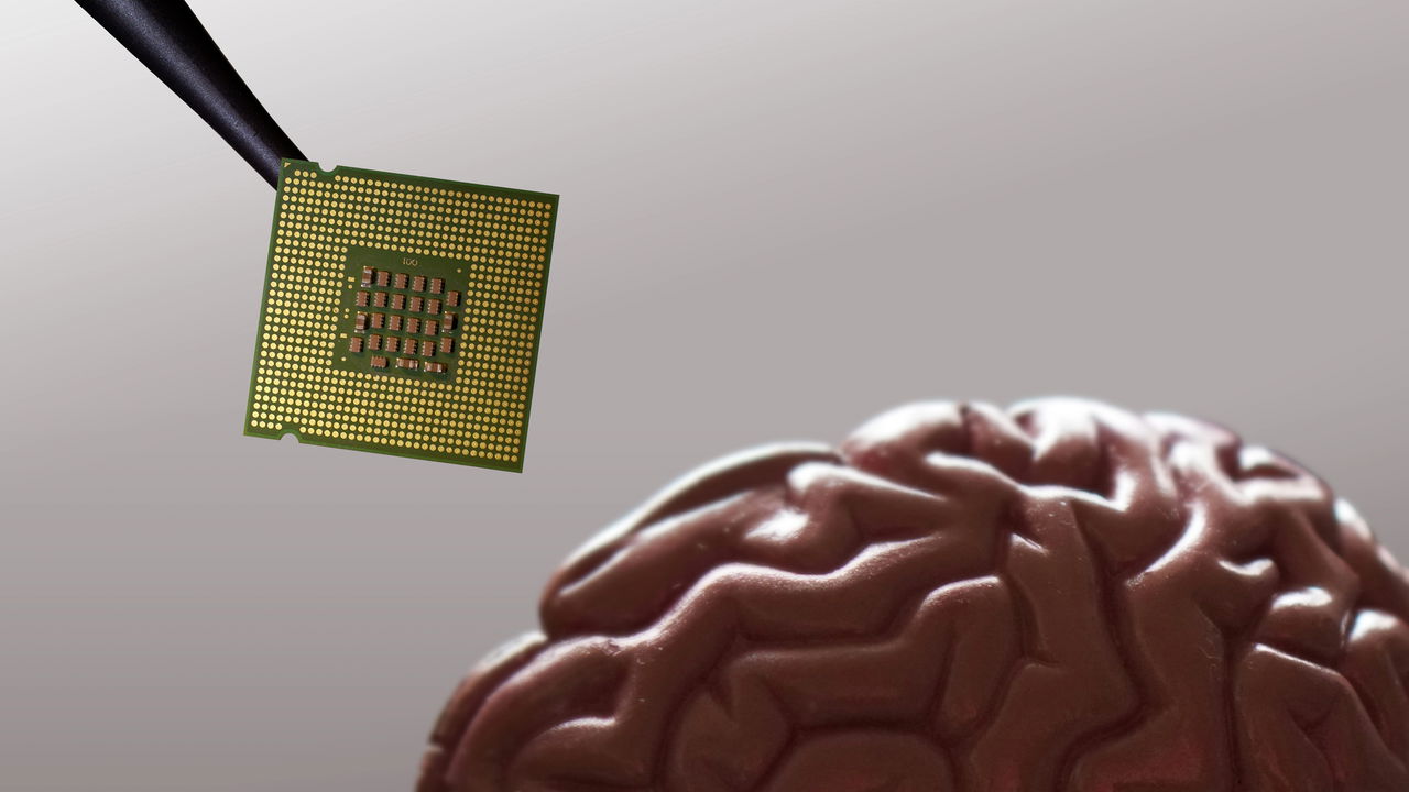 O chip mais revolucionário que lê seus pensamentos e vira fala