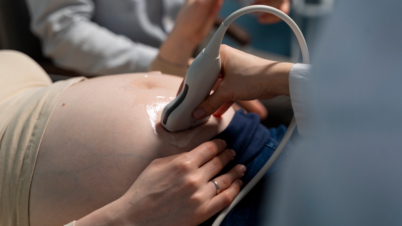 queda da fertilidade no mundo