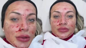 andressa urach