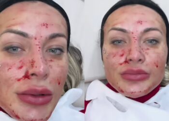 andressa urach