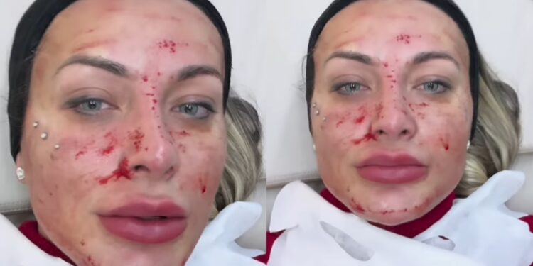 andressa urach
