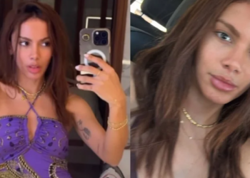 Anitta anuncia transição capilar. Imagem: Reprodução redes sociais