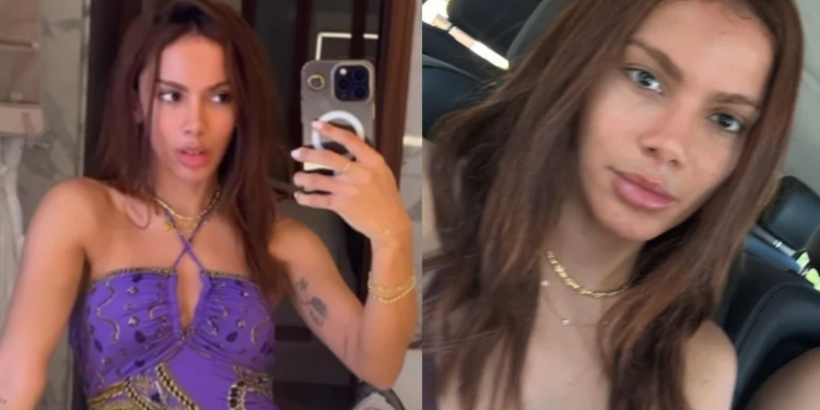 Anitta anuncia transição capilar. Imagem: Reprodução redes sociais