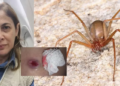 Picada de aranha marrom pode ser fata. Foto: Reprodução/ montagem G1