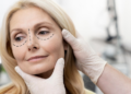 Como é feita a blefaroplastia? Foto: FreePik