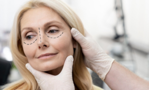 Como é feita a blefaroplastia? Foto: FreePik