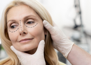 Como é feita a blefaroplastia? Foto: FreePik
