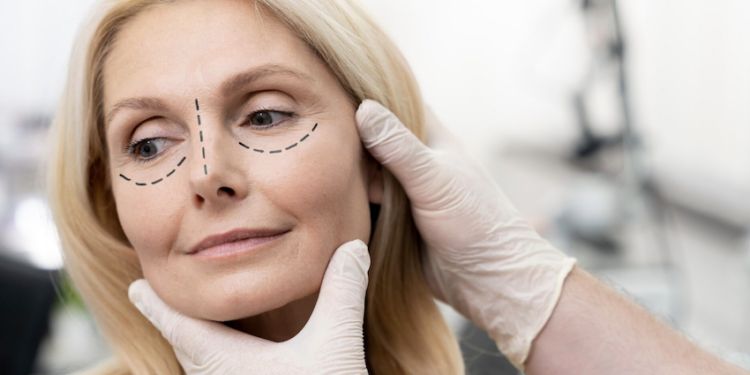 Como é feita a blefaroplastia? Foto: FreePik