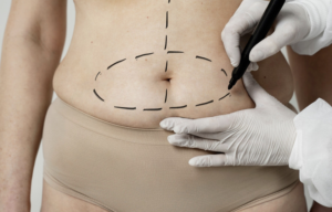 Cirurgia bariátrica na gravidez é perigosa para o bebê. Foto: FreePik