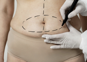 Cirurgia bariátrica na gravidez é perigosa para o bebê. Foto: FreePik