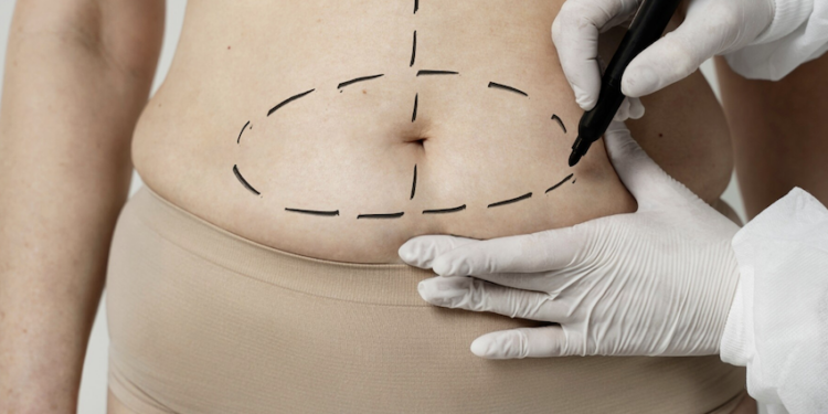 Cirurgia bariátrica na gravidez é perigosa para o bebê. Foto: FreePik