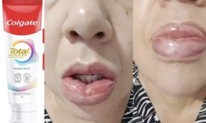 Entenda as reações adversas que o creme dental está causando. Foto: Divulgação/Perfil Brasil