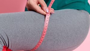 lipedema