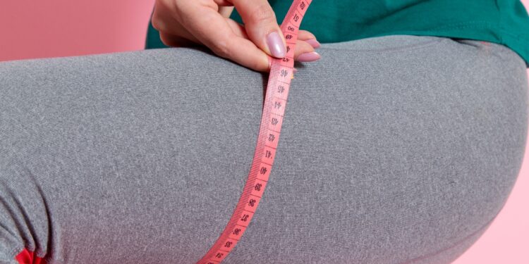 lipedema