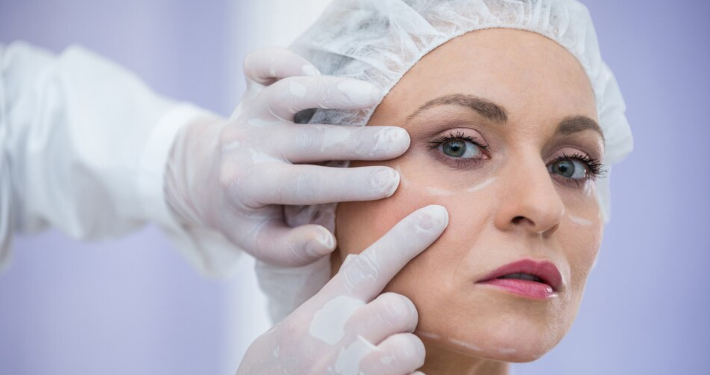 Conheça os riscos da blefaroplastia. Foto: FreePik