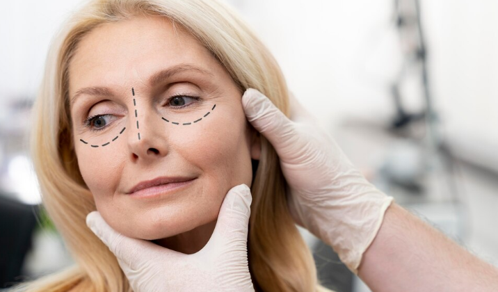 Conheça os riscos da blefaroplastia. Foto: FreePik
