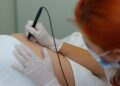 As melhores maneira de remover estrias de seu corpo