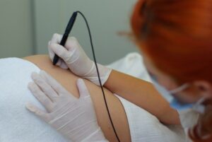 As melhores maneira de remover estrias de seu corpo