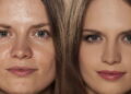 Comparativo de pele - Créditos: depositphotos.com / VGeorgiev