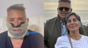 Entenda como é feita a cirurgia ortognática. Foto: Reprodução Instagram