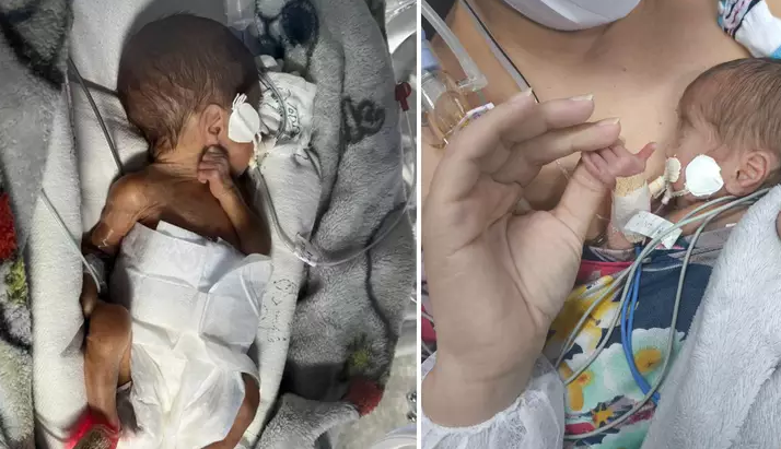 Bebê de apenas 750g tem alta. Foto: Reprodução