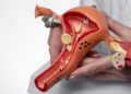 Conheça o novo exame que detecta HPV. Foto: FreePik
