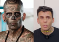 Homem mais tatuado do mundo remove tatuagens. Foto: Reprodução
