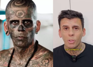 Homem mais tatuado do mundo remove tatuagens. Foto: Reprodução