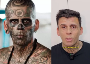 Homem mais tatuado do mundo remove tatuagens. Foto: Reprodução