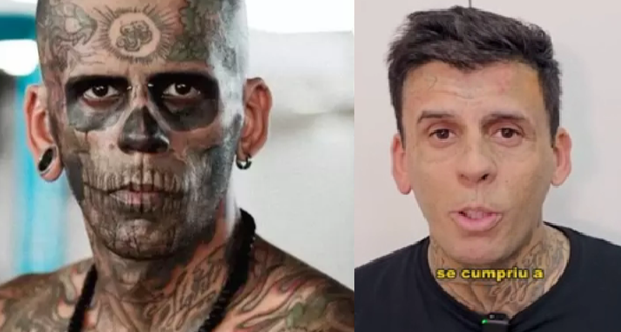 Homem mais tatuado do mundo remove tatuagens. Foto: Reprodução