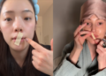 Mouth taping