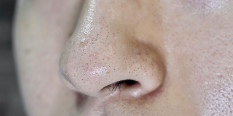 A melhor rotina de skincare para peles oleosas