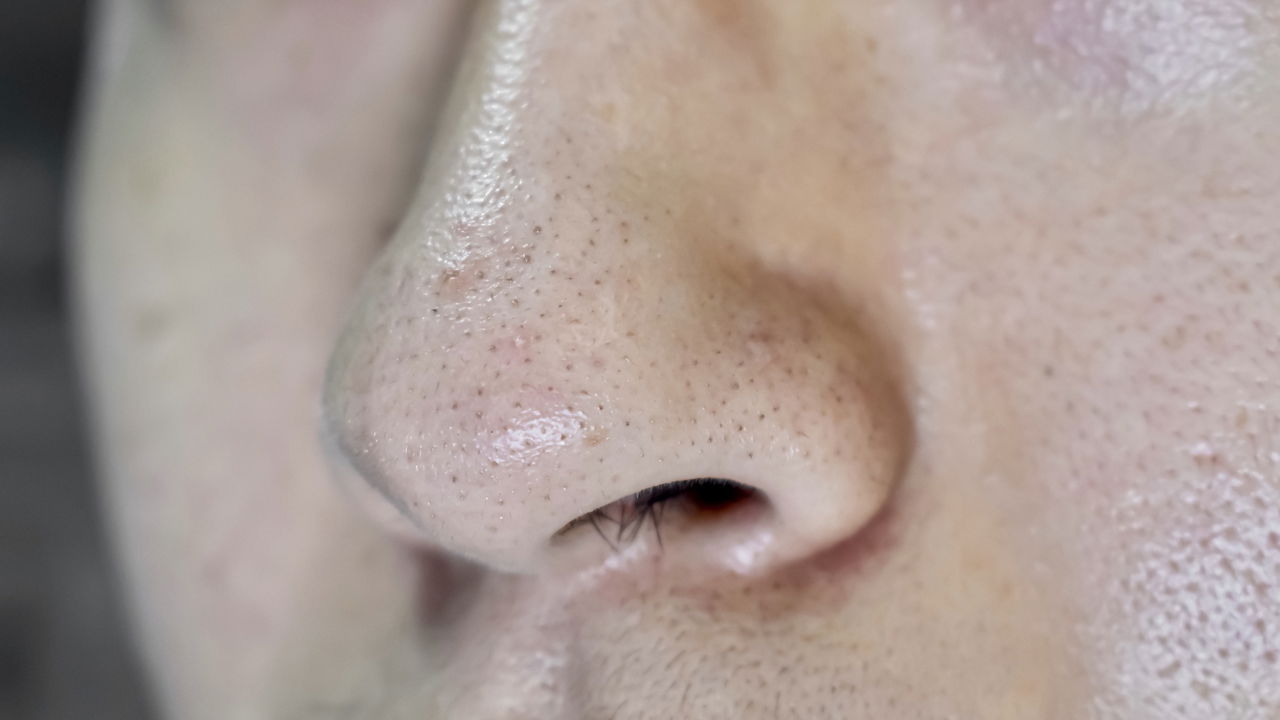 Essas são as melhores rotinas de cuidados para peles oleosas