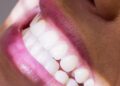 pode usar bicarbonato de sódio nos dentes