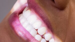 pode usar bicarbonato de sódio nos dentes