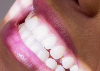 pode usar bicarbonato de sódio nos dentes