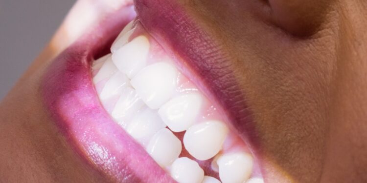 pode usar bicarbonato de sódio nos dentes