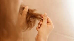 queda de cabelo
