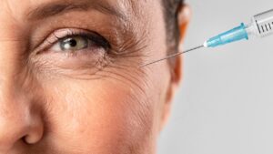 botox ajuda a prevenir rugas