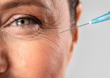 botox ajuda a prevenir rugas