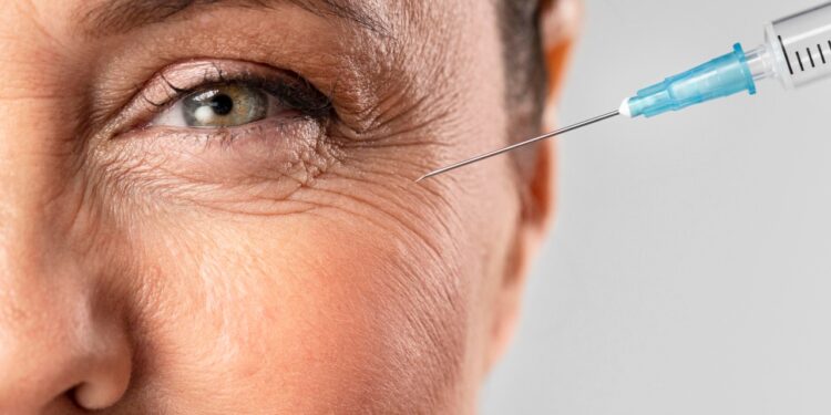 botox ajuda a prevenir rugas