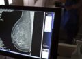 Mamografia sem dor