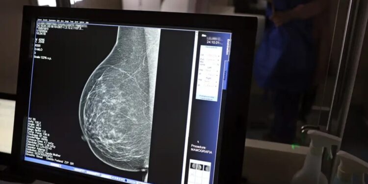 Mamografia sem dor