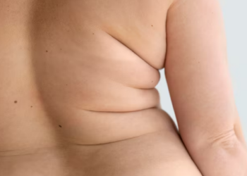 Obesidade responde por mais de um terço dos atendimentos médicos em adultos. Foto: FreePik