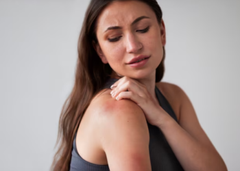 Saiba mais sobre psoríase. Foto: FreePik