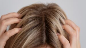 como cuidar do couro cabeludo