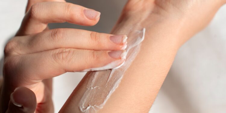 hidratantes para dermatite atópica